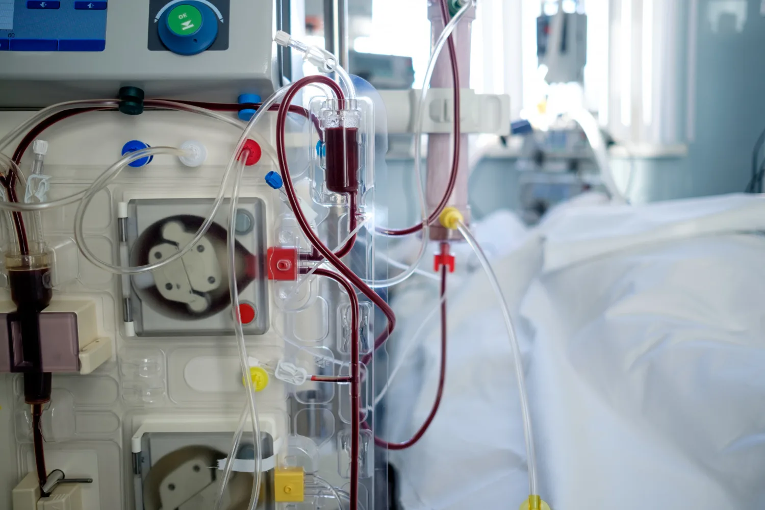 Hemodiálisis y diálisis peritoneal